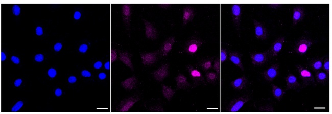 Histone H1 Antibody in Immunocytochemistry (ICC/IF)