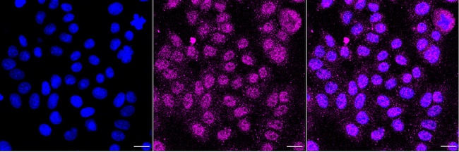 GST Omega 1 Antibody in Immunocytochemistry (ICC/IF)