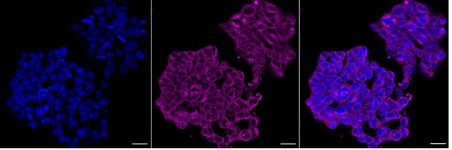 GRP94 Antibody in Immunocytochemistry (ICC/IF)