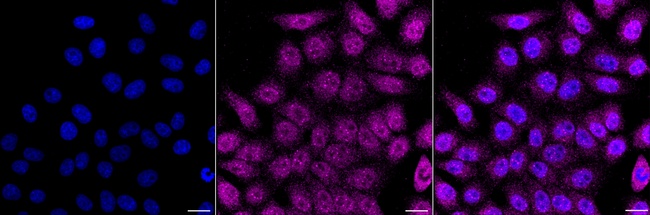 GRK2 Antibody in Immunocytochemistry (ICC/IF)