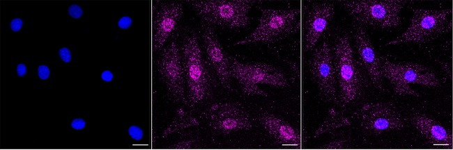 FHL1 Antibody in Immunocytochemistry (ICC/IF)