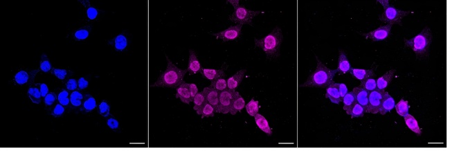 FGFR1 Antibody in Immunocytochemistry (ICC/IF)