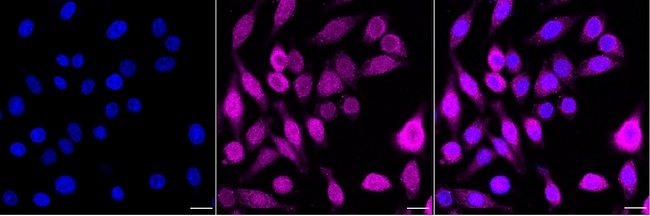 ENO1 Antibody in Immunocytochemistry (ICC/IF)