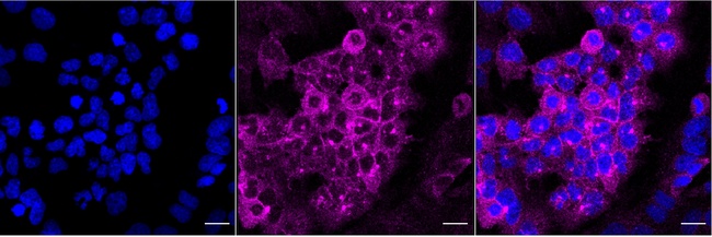 Desmocollin 3 Antibody in Immunocytochemistry (ICC/IF)