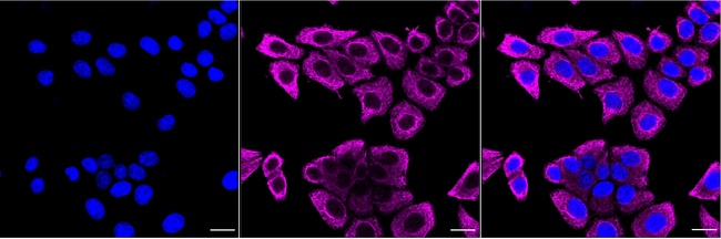 Cytokeratin 8 Antibody in Immunocytochemistry (ICC/IF)