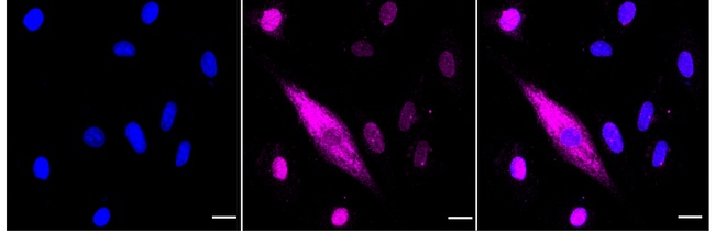Cytokeratin 4 Antibody in Immunocytochemistry (ICC/IF)