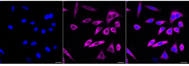 Cytokeratin 18 Antibody in Immunocytochemistry (ICC/IF)