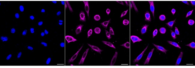 Cytokeratin 18 Antibody in Immunocytochemistry (ICC/IF)