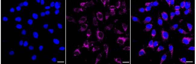 Cytokeratin 17 Antibody in Immunocytochemistry (ICC/IF)