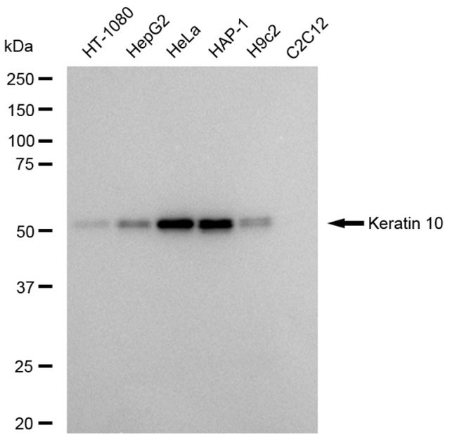 Cytokeratin 10 Antibody in Western Blot (WB)