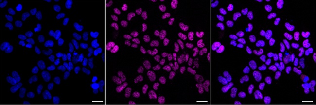 Cyclin T1 Antibody in Immunocytochemistry (ICC/IF)
