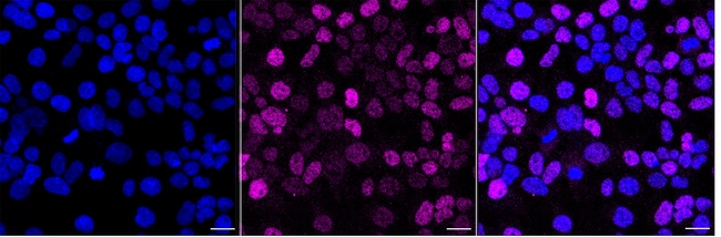 Cyclin E Antibody in Immunocytochemistry (ICC/IF)