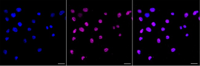 CREB Antibody in Immunocytochemistry (ICC/IF)