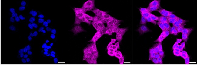 Creatine Kinase BB Antibody in Immunocytochemistry (ICC/IF)