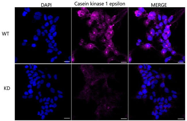 CK1 epsilon Antibody in Immunocytochemistry (ICC/IF)
