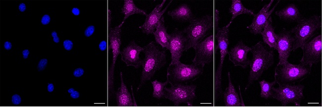 CK1 alpha Antibody in Immunocytochemistry (ICC/IF)