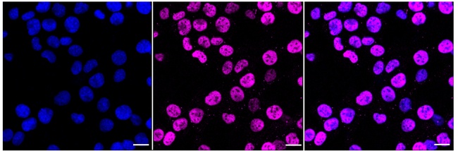 c-Jun Antibody in Immunocytochemistry (ICC/IF)