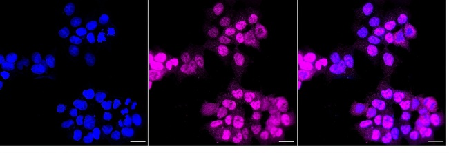 CDK6 Antibody in Immunocytochemistry (ICC/IF)