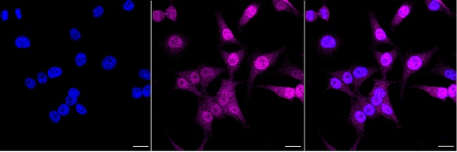 CDK6 Antibody in Immunocytochemistry (ICC/IF)