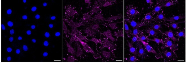 CD61 Antibody in Immunocytochemistry (ICC/IF)
