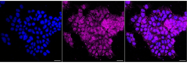 Caspase 6 Antibody in Immunocytochemistry (ICC/IF)