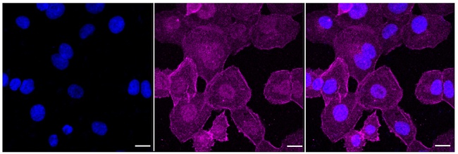 Caspase 6 Antibody in Immunocytochemistry (ICC/IF)