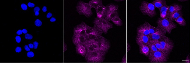 Caspase 1 Antibody in Immunocytochemistry (ICC/IF)