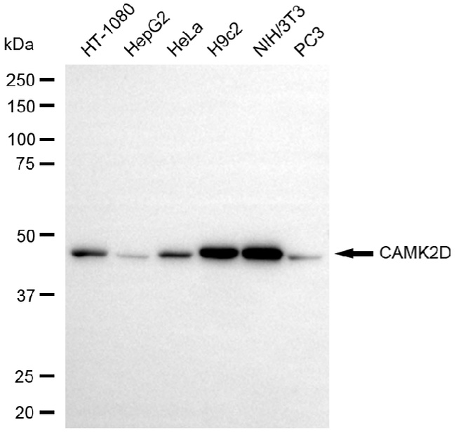CaMKII delta Antibody in Western Blot (WB)