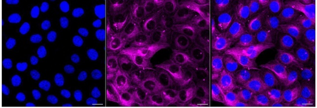 Beta III Tubulin Antibody in Immunocytochemistry (ICC/IF)