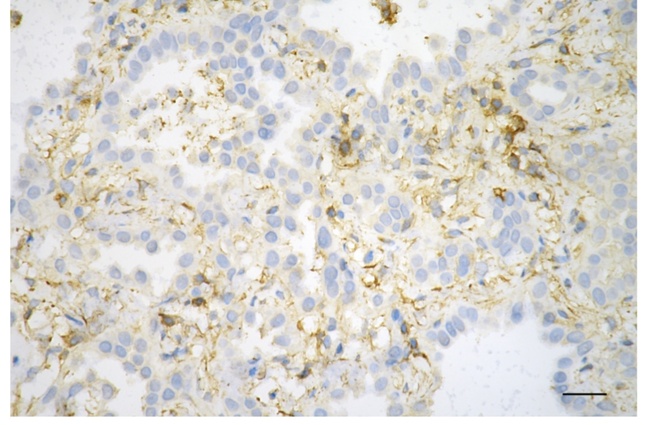 beta Actin Antibody in Immunohistochemistry (Paraffin) (IHC (P))