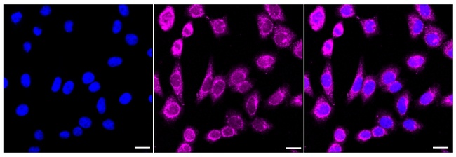 BDNF Antibody in Immunocytochemistry (ICC/IF)