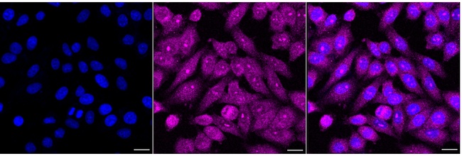 BCR Antibody in Immunocytochemistry (ICC/IF)