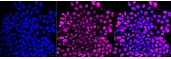 Aurora B Antibody in Immunocytochemistry (ICC/IF)