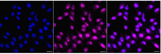ATP6V1A Antibody in Immunocytochemistry (ICC/IF)