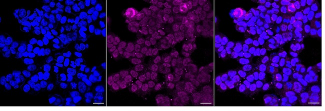 APOE Antibody in Immunocytochemistry (ICC/IF)