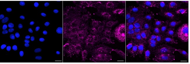 alpha Actinin 4 Antibody in Immunocytochemistry (ICC/IF)