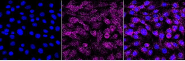 AKT3 Antibody in Immunocytochemistry (ICC/IF)