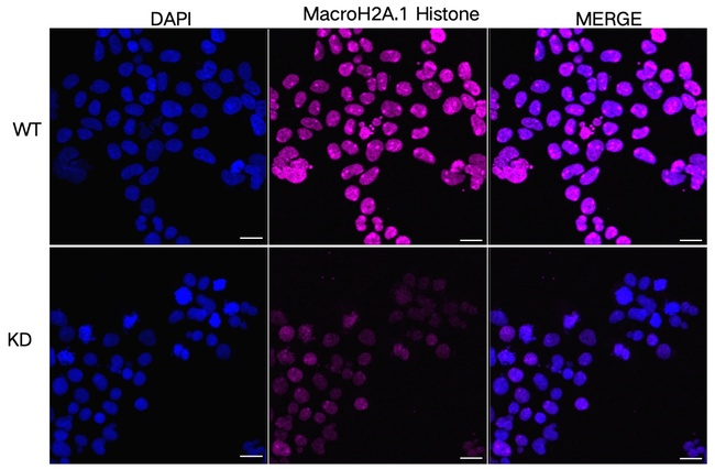 Histone Macro-H2A.1 Antibody in Immunocytochemistry (ICC/IF)