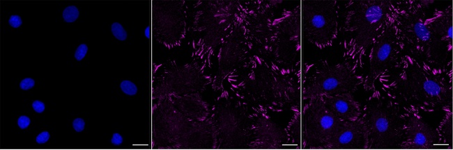 Zyxin Antibody in Immunocytochemistry (ICC/IF)