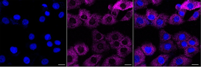 ZNF598 Antibody in Immunocytochemistry (ICC/IF)