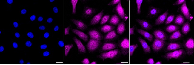 YAP1 Antibody in Immunocytochemistry (ICC/IF)