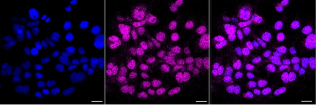 XRCC3 Antibody in Immunocytochemistry (ICC/IF)