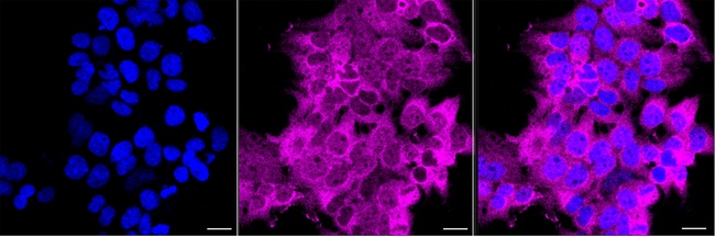 WDR77 Antibody in Immunocytochemistry (ICC/IF)