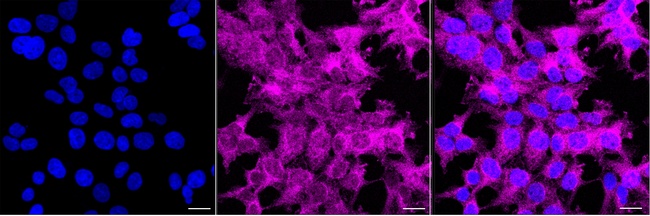 WDR77 Antibody in Immunocytochemistry (ICC/IF)