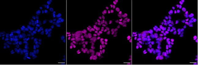 VRK1 Antibody in Immunocytochemistry (ICC/IF)