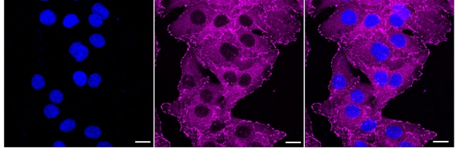 Vinculin Antibody in Immunocytochemistry (ICC/IF)
