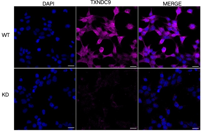 TXNDC9 Antibody in Immunocytochemistry (ICC/IF)
