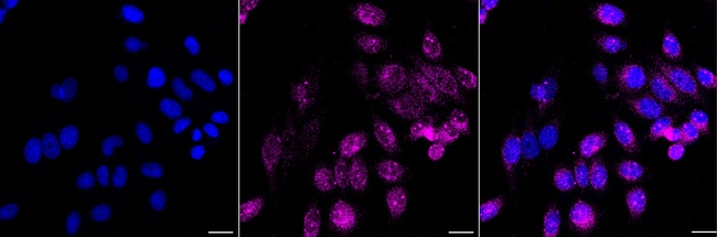TXNDC5 Antibody in Immunocytochemistry (ICC/IF)