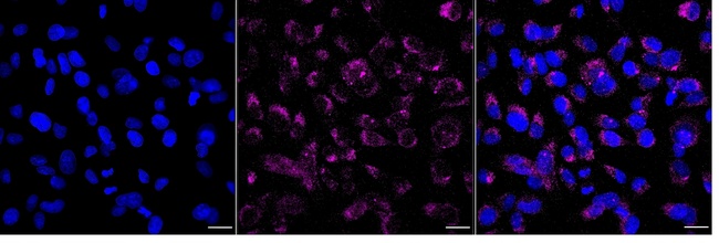 TXNDC5 Antibody in Immunocytochemistry (ICC/IF)