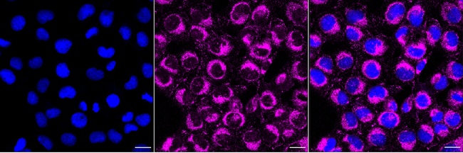 TSPO Antibody in Immunocytochemistry (ICC/IF)